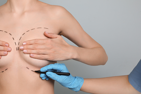 5 Types of Breast Surgery & What They Can Do for You